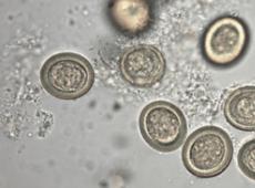 Kotoran telur cacing, cara tes protozoanya;