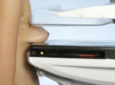 ડિફ્યુઝ મેસ્ટોપથી - સ્તનધારી ગ્રંથિની પેથોલોજીનું નિદાન અને સારવાર